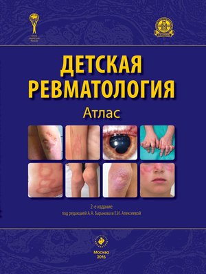 cover image of Детская ревматология. Атлас